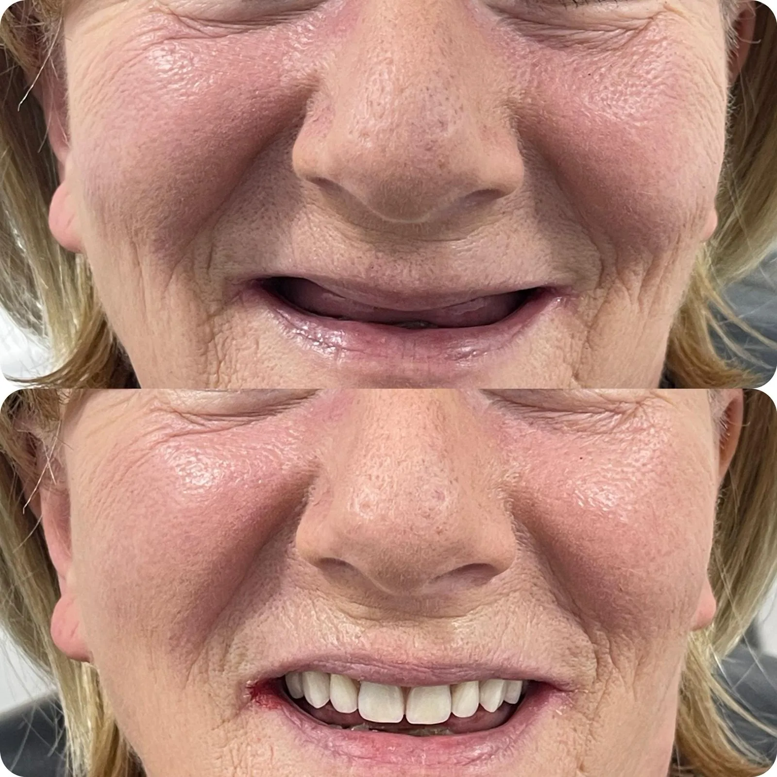 Before and after dental treatment