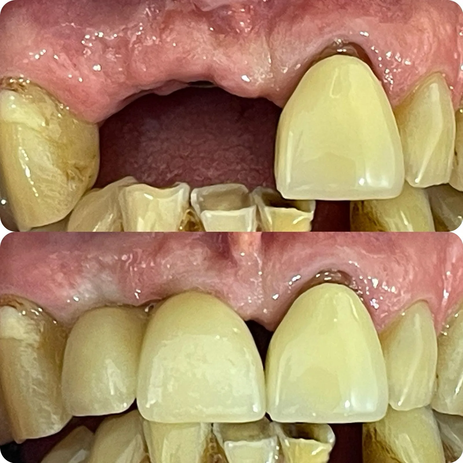 Before and after dental treatment