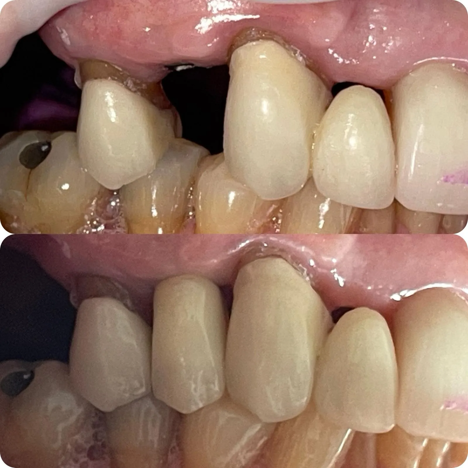 Before and after dental treatment