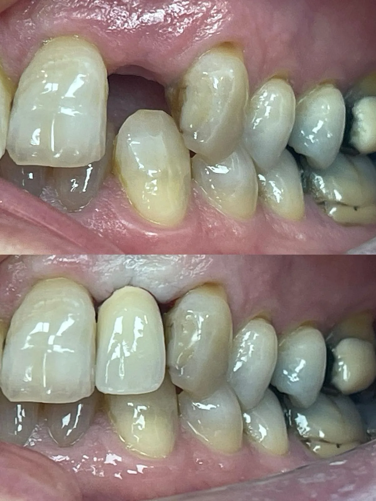 Before and after dental treatment